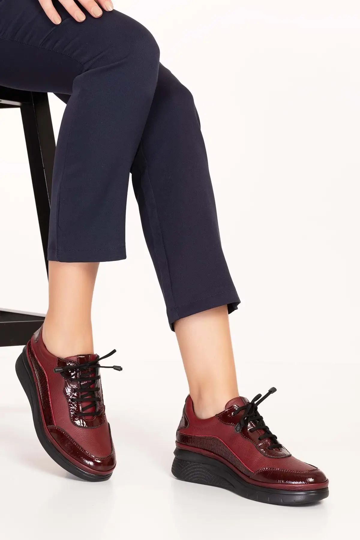 کفش زنانه راحتی آناتومیک با کفی چرم طبیعی مدل Usl.2153 برند Gondol - 8497