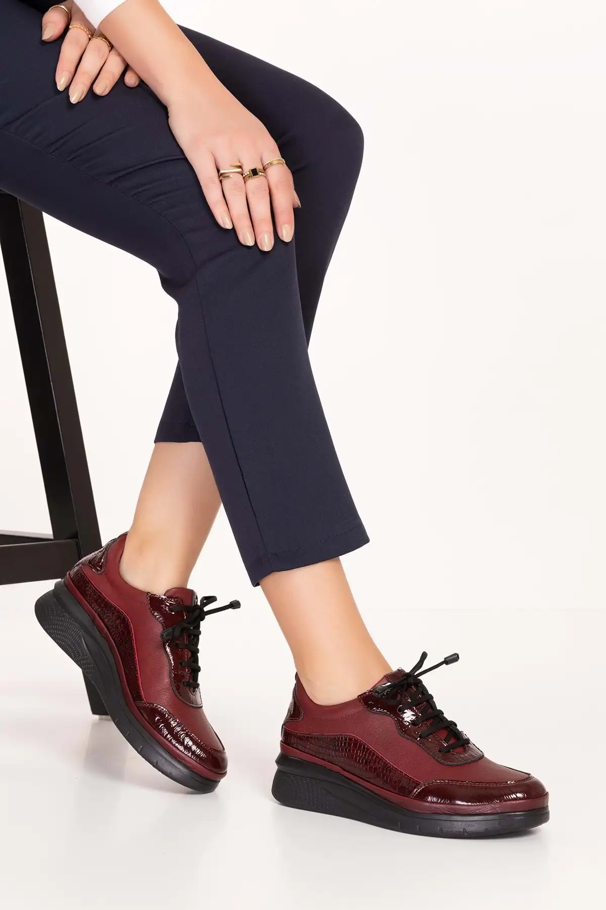 کفش زنانه راحتی آناتومیک با کفی چرم طبیعی مدل Usl.2153 برند Gondol - 8497