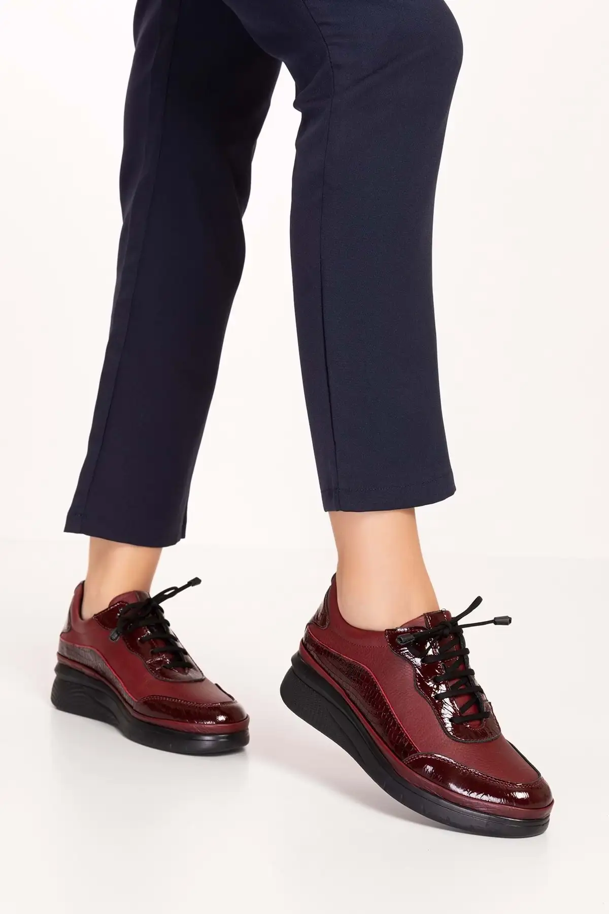 کفش زنانه راحتی آناتومیک با کفی چرم طبیعی مدل Usl.2153 برند Gondol - 8497